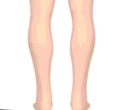 Orthopedic Arch Support Sandals For Women